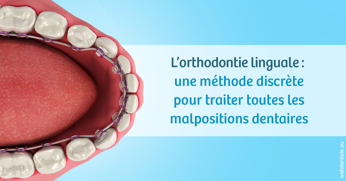 https://selarl-cabinet-dentaire-victor-hugo.chirurgiens-dentistes.fr/L'orthodontie linguale 1