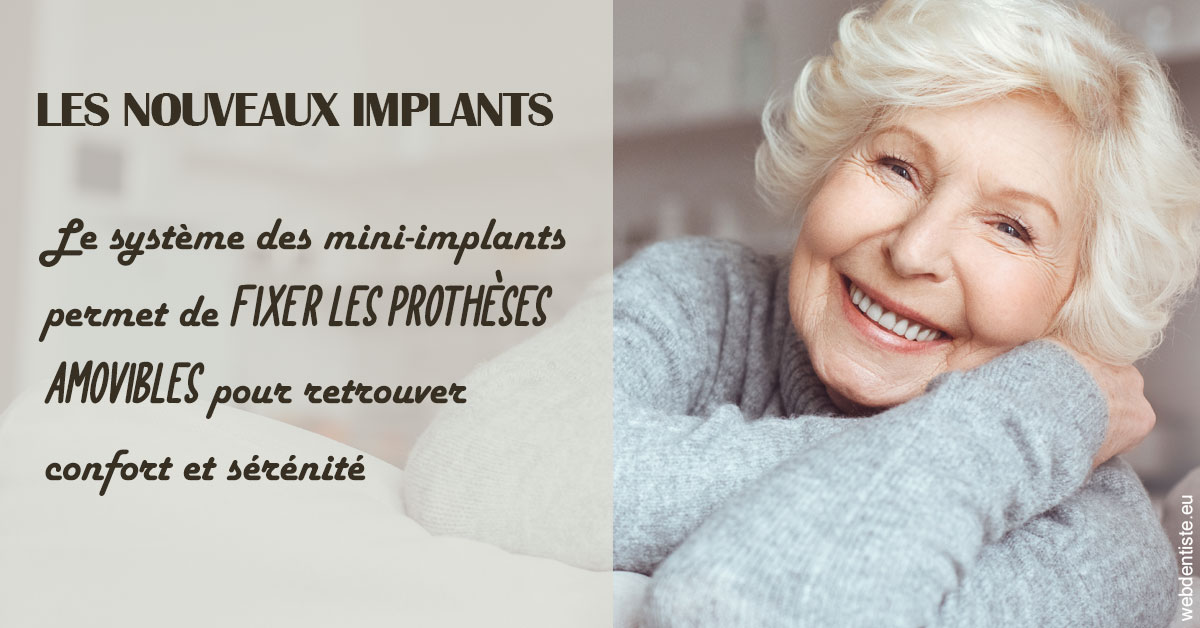 https://selarl-cabinet-dentaire-victor-hugo.chirurgiens-dentistes.fr/Les nouveaux implants 1