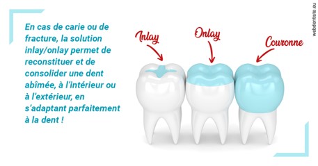 https://selarl-cabinet-dentaire-victor-hugo.chirurgiens-dentistes.fr/L'INLAY ou l'ONLAY