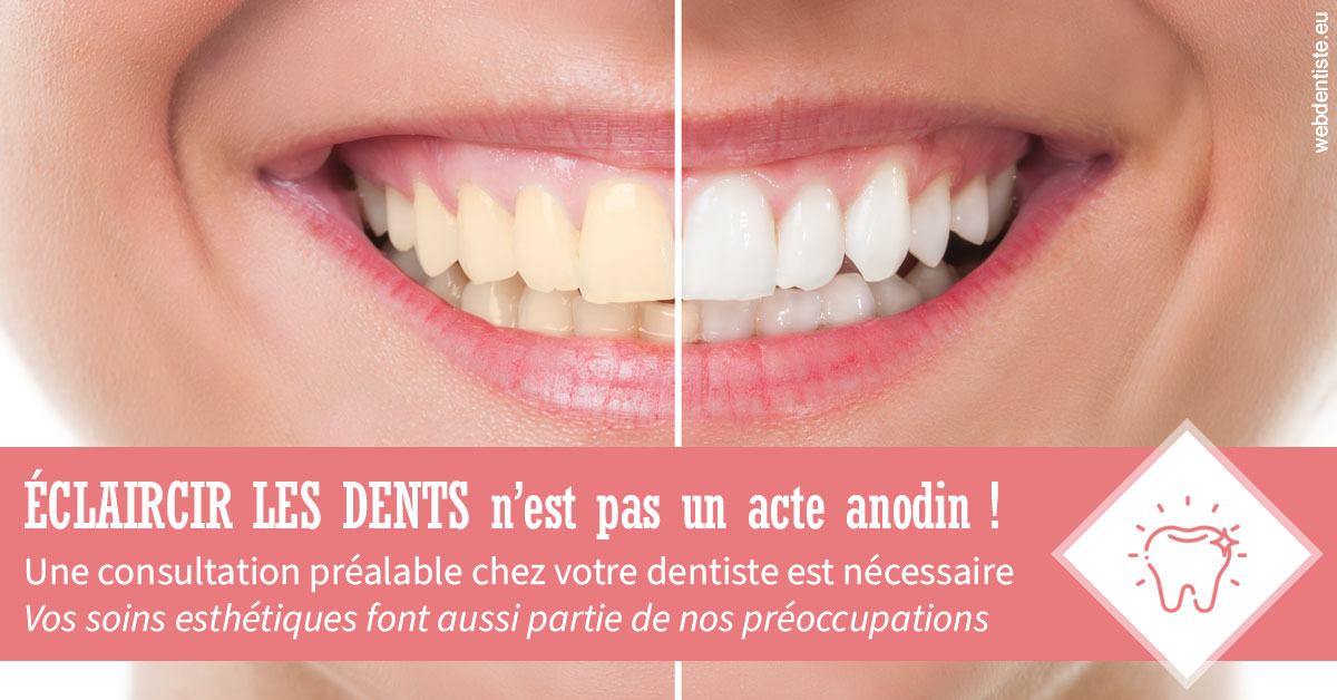 https://selarl-cabinet-dentaire-victor-hugo.chirurgiens-dentistes.fr/Eclaircir les dents 1