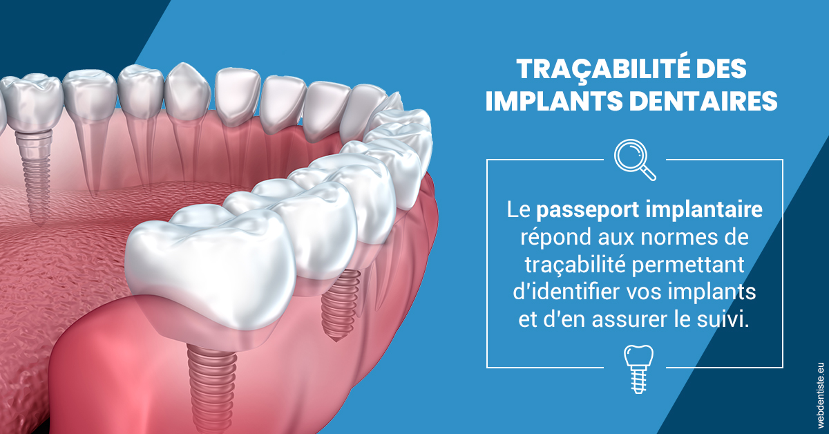 https://selarl-cabinet-dentaire-victor-hugo.chirurgiens-dentistes.fr/T2 2023 - Traçabilité des implants 1
