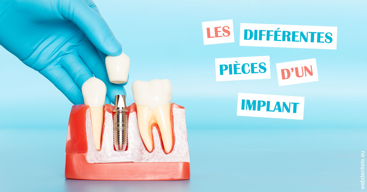 https://selarl-cabinet-dentaire-victor-hugo.chirurgiens-dentistes.fr/Les différentes pièces d’un implant 2