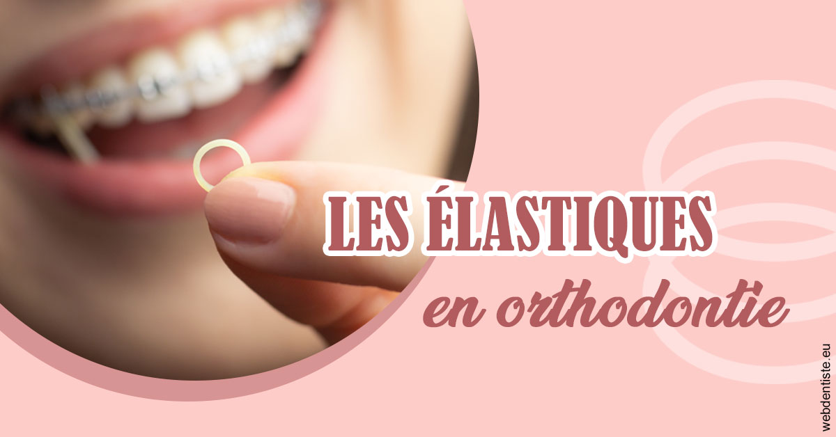 https://selarl-cabinet-dentaire-victor-hugo.chirurgiens-dentistes.fr/Elastiques orthodontie 1