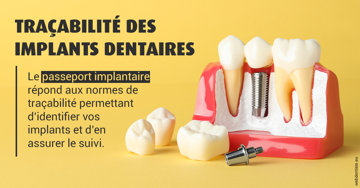 https://selarl-cabinet-dentaire-victor-hugo.chirurgiens-dentistes.fr/T2 2023 - Traçabilité des implants 2
