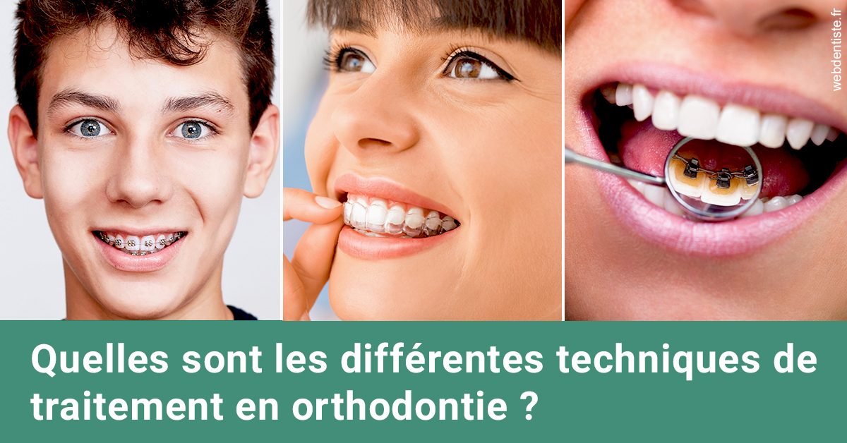 https://selarl-cabinet-dentaire-victor-hugo.chirurgiens-dentistes.fr/Les différentes techniques de traitement 2
