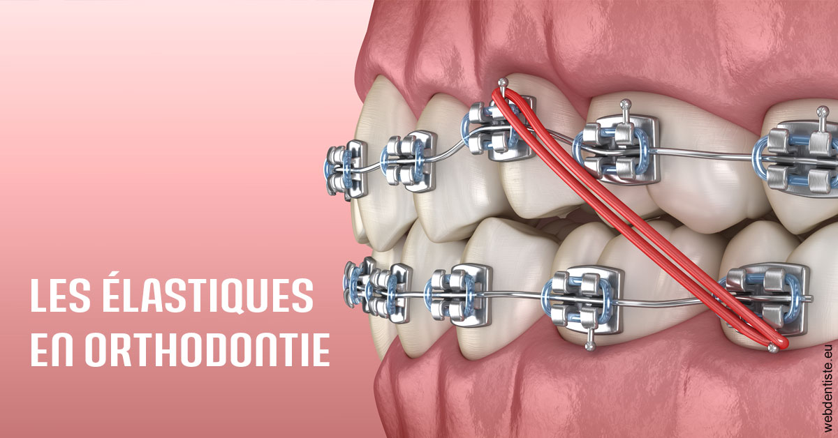 https://selarl-cabinet-dentaire-victor-hugo.chirurgiens-dentistes.fr/Elastiques orthodontie 2